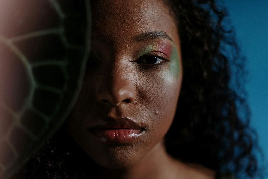 How Do You Know When to See a Dermatologist for Acne? Signs and Expert Advice