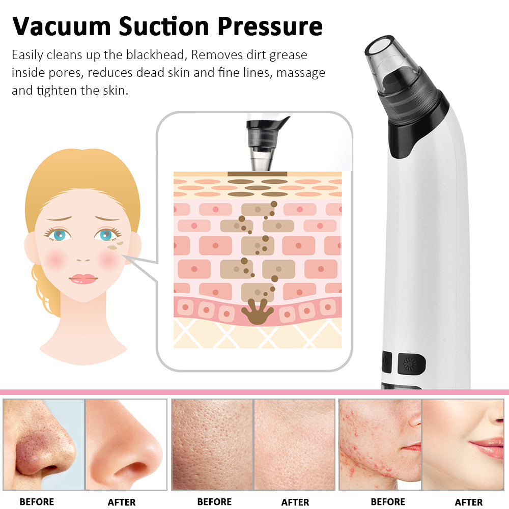 Rechargeable Pore Vacuum Facial Cleanser & Blackhead Extractor