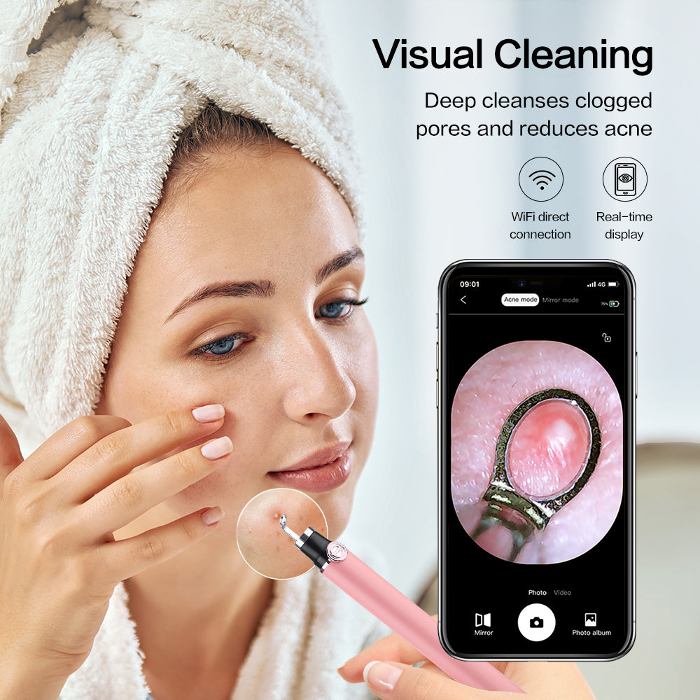 Visual Blackhead Remover