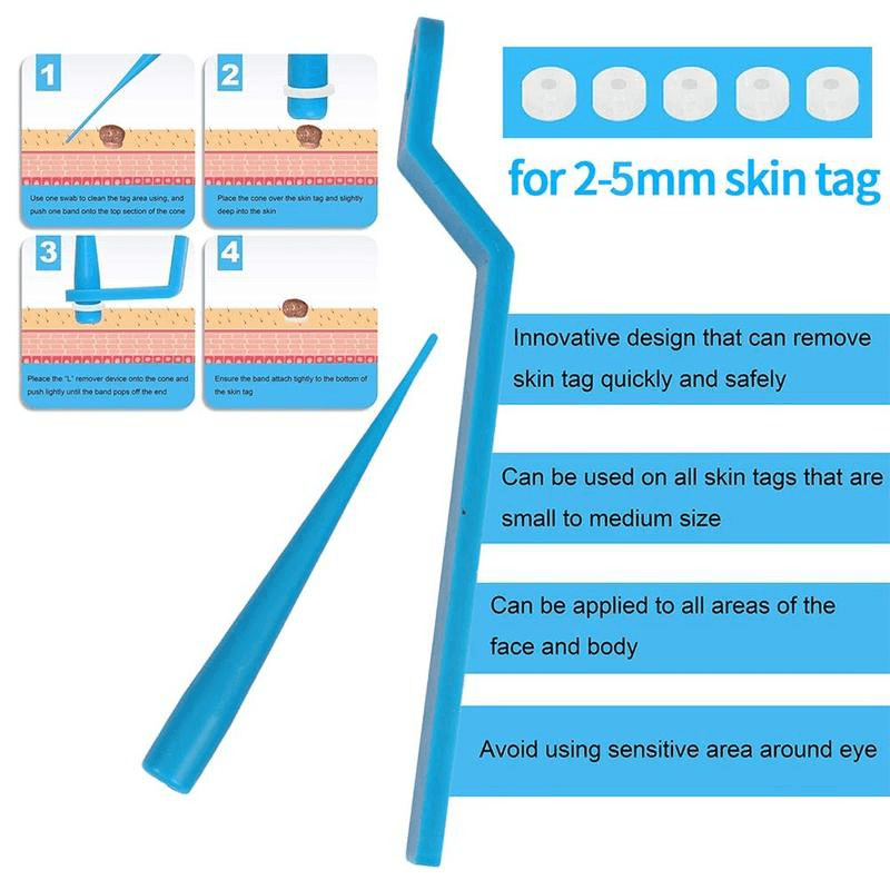 Skin Tag Kill Skin Mole Wart Remover Micro Band Skin Tag Removal Kit Adult Mole Wart Face Care - Trendha