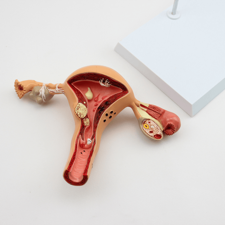 1Pcs Uterus Ovary Anatomical Medical Model Anatomy Cross-Section Science Toy with Base - Trendha